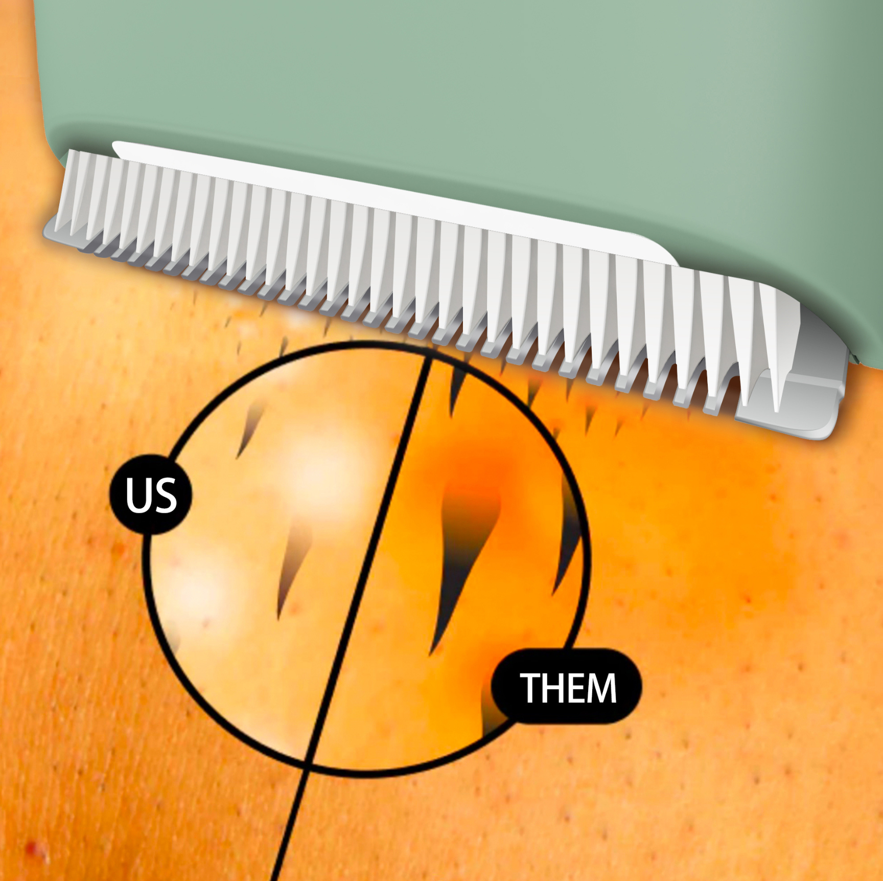 vavame performs better than the other trimmers on intimate grooming. It's skin-safe tech ensures you a worry free grooming experience. 